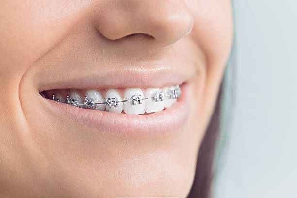 Best Wisdom Tooth Removal  in Plumas Lake, CA